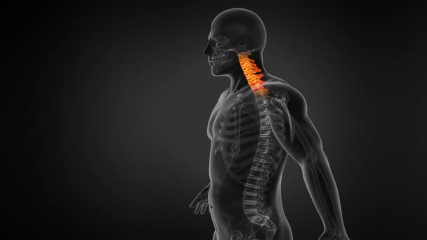 Anatomy Human Spine Neck Pain Seamless Loop — Stock Video