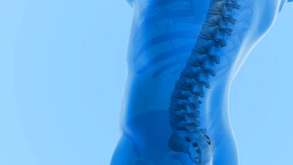 Medizinische Figur Mit Schmerzhafter Wirbelsäule — Stockfoto