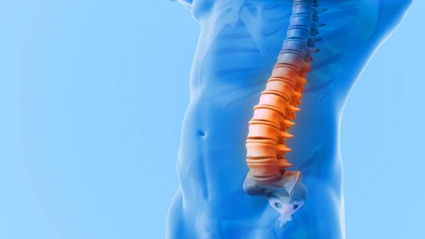 Figura Médica Con Una Columna Vertebral Dolorosa —  Fotos de Stock