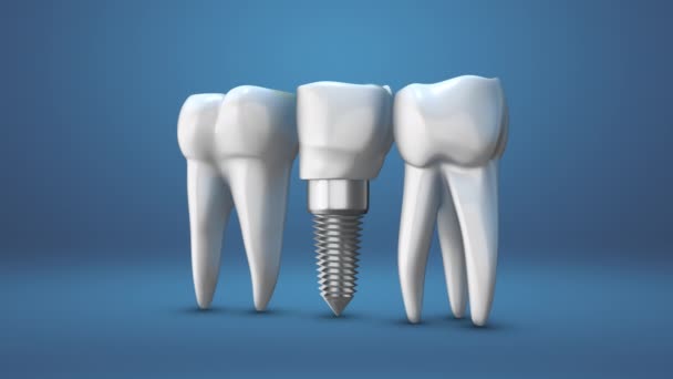 Animação Dos Dentes Humanos Dentaduras — Vídeo de Stock