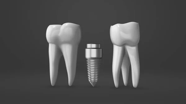Proces Montażu Implantu Zęba Korony — Zdjęcie stockowe