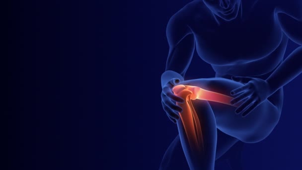 Πόνος Στο Πόδι Ιατρική Κινούμενη Εικόνα — Αρχείο Βίντεο