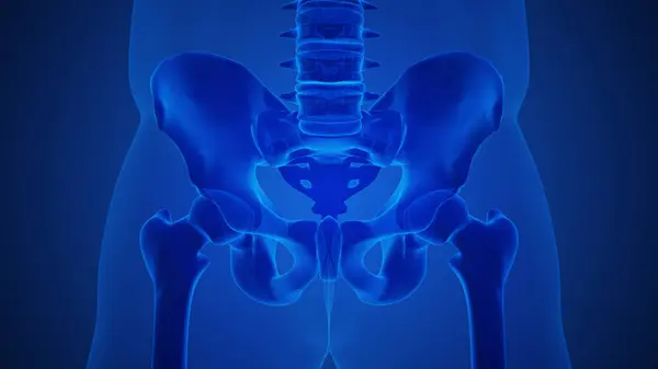 Conceito Anatomia Uma Articulação Artrítica Sacroilíaca — Fotografia de Stock