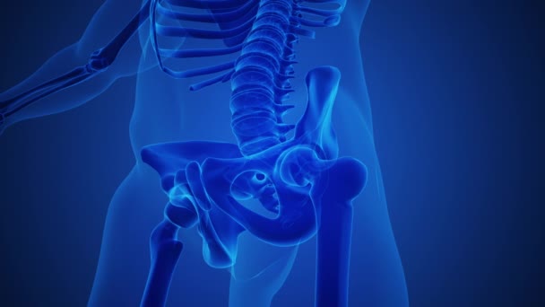 Csontváz Osteoarthritis Csípőízületi Sérüléssel — Stock videók
