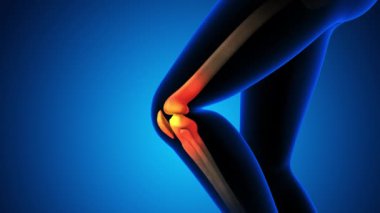diz eklem ağrısı