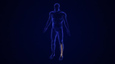 Kırık Fibula Kemiği Ağrısı Tıbbi Konsepti