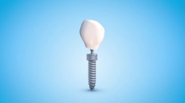 Diş implantını kapat.