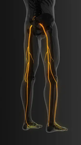 İki bacağında da ağrılı siyatik sinir var.