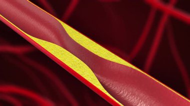 Kan Damarlarını Destekleyen Stent İmplantasyonu