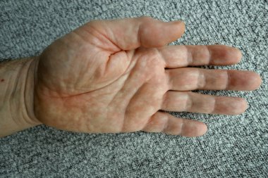 Human body, hand, fingers, white, old person