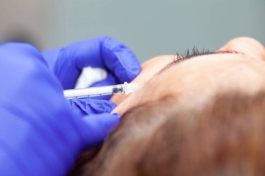 Dermatolog orta yaşlı bir kadın hastaya Botulinum toksini uyguluyor. Estetik tıp.