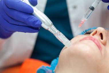 Mikro iğneler kullanılarak yaşlanma önleyici yüz gençleştirme kokteyli uygulanması. Dermatoloji konsepti. Estetik tıp konsepti.