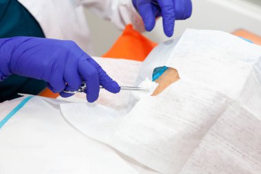 Dermatolog, yaşlı bir hastanın yüzünde deri biyopsisi yapıyor.