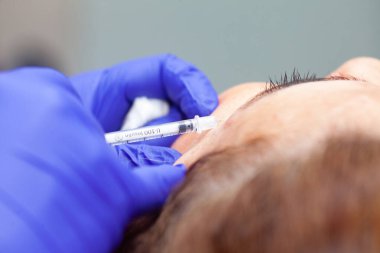 Dermatolog orta yaşlı bir kadın hastaya Botulinum toksini uyguluyor. Estetik tıp.