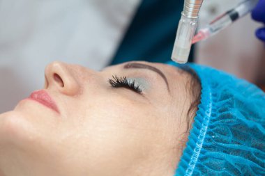 Mikro iğneler kullanılarak yaşlanma önleyici yüz gençleştirme kokteyli uygulanması. Dermatoloji konsepti. Estetik tıp konsepti.