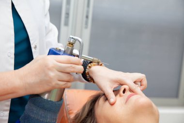 Dermatolog, yaşlı bir kadın hastaya deri lezyonları için kriyoterapi uyguluyor..