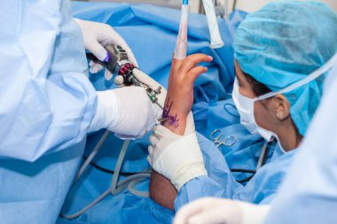 Bir grup cerrah ortopedik ameliyat yapıyor. Kadın bir doktor ameliyat yapıyor. Ortopedik cerrah. Ameliyat ve sigorta konsepti.