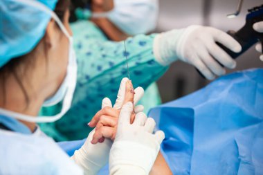 Kadın bir doktor ameliyat yapıyor. Ortopedik cerrah. Ameliyat ve sigorta konsepti. El ameliyatı. Travmatoloji ve ortopedi konsepti.