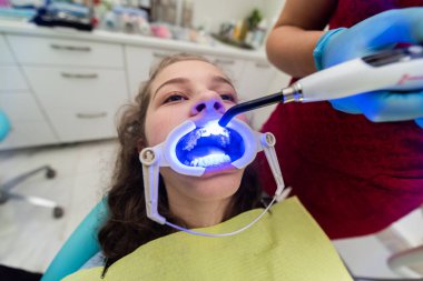 The dentist uses an ultraviolet lamp while fitting the girl with braces.  clipart