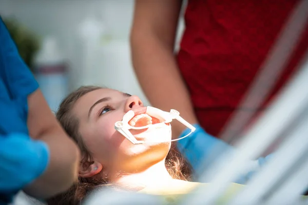 Dentist appointment at a dental clinic, placing braces locks on the teeth and pulling the archwire to fix it. 