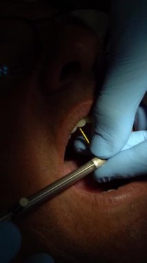 İmplant işlemi sırasında diş implantı içine diş implantı yerleştirmek için tork anahtarı kullanan bir dişçinin videosunu kapat.. 