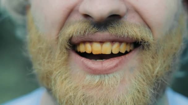 ホームレスの人の笑顔や汚れのない人 汚い歯と黄色い髭のクローズアップ — ストック動画