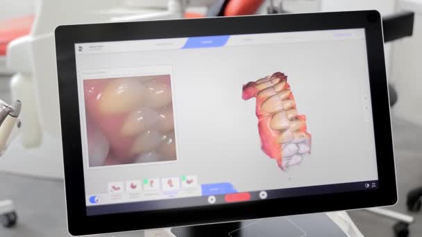 Digitalização Dos Dentes Olhando Para Tela Digitalizando Mandíbula Dentária Espaço — Vídeo de Stock