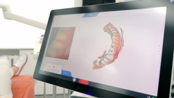 Privind Ecranul Scanând Maxilarul Dentar Spațiu Stomatologie Modernă Scanarea Dinților — Videoclip de stoc