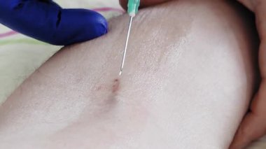 Koldaki damara yaklaşan iğnenin yakın çekimi, tıbbi enjeksiyon sırasında eldivenli ellerin rehberliğinde, hassasiyet ve steril sağlık pratiğini vurgulayarak,