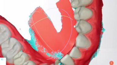 Üst çene, diş ve diş etlerinin ortodontik veya protez kullanımı için modellenmiş 3B dijital diş taraması.