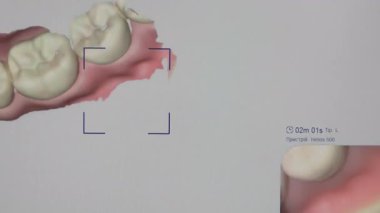 Modern Diş Hekimliği Kliniğinde Alt Çene ve Diş Yapısını Gösteren Dijital 3D Diş Taraması, Oral Sağlık ve Tıbbi Teşhis Teknolojisinin detaylı görselleştirilmesi.