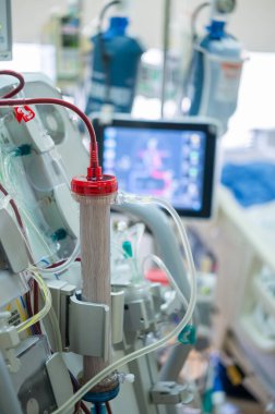 Uzmanlar yoğun bakım ünitelerindeki kritik hastalarda kullanmak üzere bir diyaliz makinesi hazırlıyorlar..