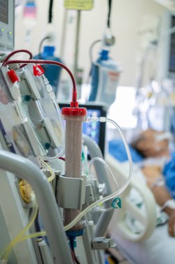 Uzmanlar yoğun bakım ünitelerindeki kritik hastalarda kullanmak üzere bir diyaliz makinesi hazırlıyorlar..