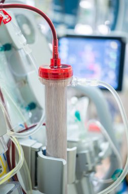 Uzmanlar yoğun bakım ünitelerindeki kritik hastalarda kullanmak üzere bir diyaliz makinesi hazırlıyorlar..