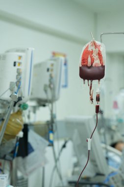 Hasta, kan kaybını önlemek için kan bileşenleri alıyor..