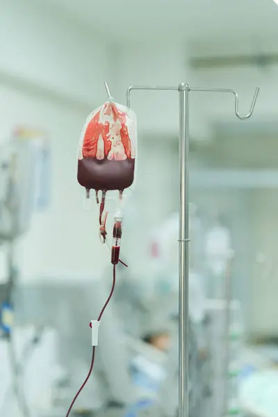 Paciente Está Recebendo Componentes Sanguíneos Para Substituir Sangue Perdido Para — Fotografia de Stock