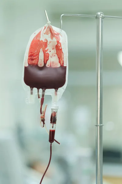 Patient Receiving Blood Components Replace Lost Blood Prevent Hypovolemic Shock — Stock Photo, Image