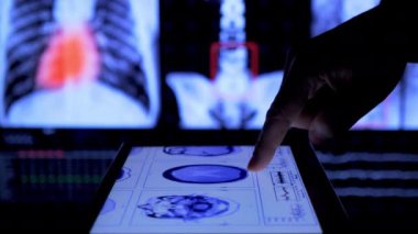 Doctor examine mri scan on tablet