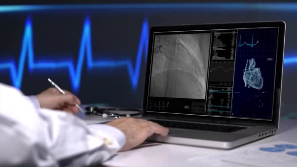 Coronary Angiography Laptop — Stockvideo