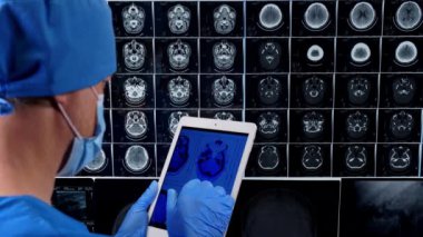 Doctor using tablet and looking at brain scan