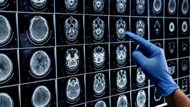 Análisis Por Resonancia Magnética Cerebral — Vídeo de stock
