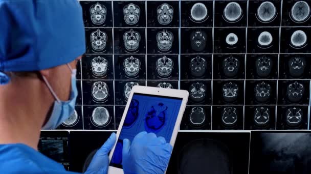Médico Usando Tablet Olhando Para Varredura Cérebro — Vídeo de Stock