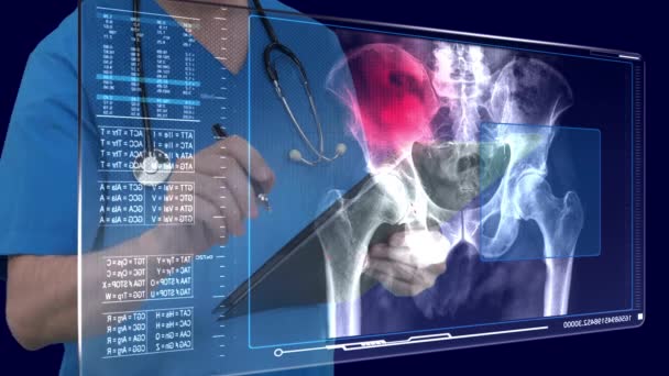 Csontritkulás Vizsgálata Orvos Munkahelyen — Stock videók