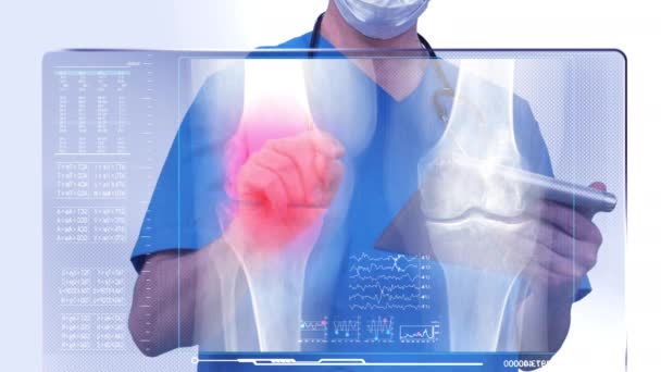 Chirurgien Regardant Radiographie Des Jambes — Video