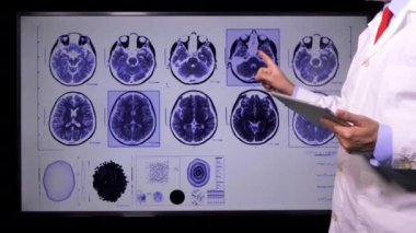Doktor, Beyin Sinyali Muayenesi
