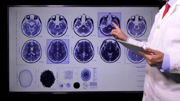 Orvos Brain Vizsgálat — Stock videók