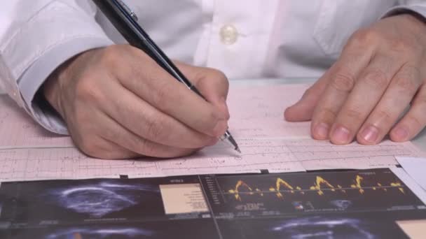 Doctor Looking Cardiogram Vista Cerca — Vídeo de stock