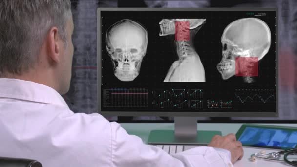 Врач Офисе Смотрит Рентген — стоковое видео