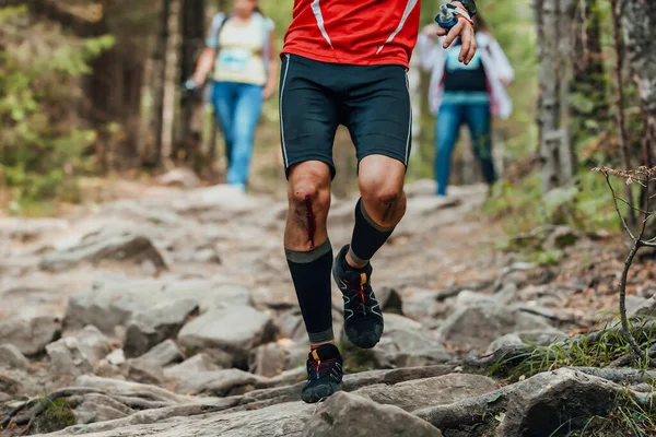 Male Runner Compression Sleeves Running Forest Trail Race Stones Knee — Stock Photo, Image