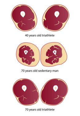 Comparison of muscle mass and strength vector illustration isolated on white background. Cross section of muscle mass of triathlete and sedentary man in different ages. Anatomy and health care concept illustration.